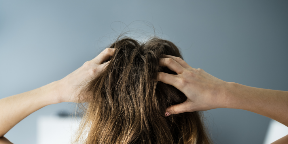 vrouw die in haar haren krabt omwille van een droge hoofdhuid